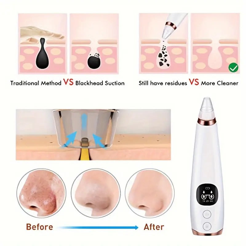 Purgato Multi-Functional Blackhead Remover Device